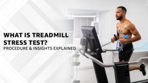 What is Treadmill Test? Exercise Stress Explained